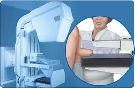 mammogram1
